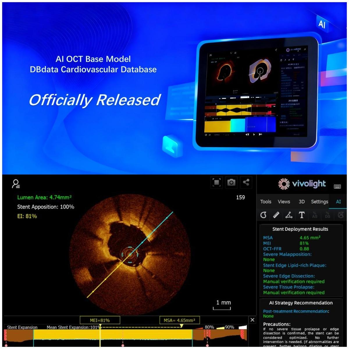 لا نتبع، بل نُحدد! التصوير داخل الأوعية الدموية في الصين يدخل عصر 